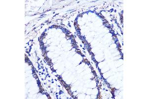 Immunohistochemistry of paraffin-embedded Human colon using OTUD7B Rabbit pAb (ABIN7269125) at dilution of 1:100 (40x lens). (OTUD7B anticorps  (AA 530-700))