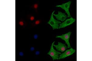 ABIN6264007 and ABIN6277984 staining Hela cells by IF/ICC. (Poly(A) Binding Protein, Cytoplasmic, Pseudogene 2 (PABPCP2) (C-Term) anticorps)