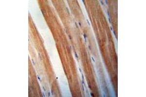 Immunohistochemistry analysis in formalin fixed and paraffin embedded human skeletal muscle reacted with KBTBD5 Antibody (Center) followed which was peroxidase conjugated to the secondary antibody and followed by DAB staining. (KBTBD5 anticorps  (Middle Region))