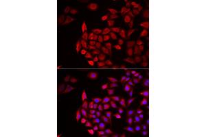 Immunofluorescence analysis of HeLa cells using COCH antibody (ABIN6132126, ABIN6138819, ABIN6138820 and ABIN6222234). (COCH anticorps  (AA 20-260))
