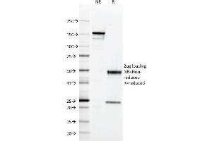 anti-MHC Class II HLA-DQ (HLA-DQ) antibody