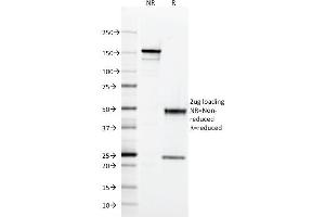 SDS-PAGE Analysis Purified HLA-DQ Mouse Monoclonal Antibody (SPV-L3). (HLA DQ anticorps)
