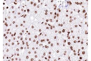 ABIN6272455 at 1/100 staining human liver tissue sections by IHC-P. (USP36 anticorps)