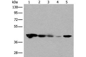 Western blot analysis of Jurkat HEPG2 and Hela cell Human testis tissue 231 cell lysates using CECR5 Polyclonal Antibody at dilution of 1:650