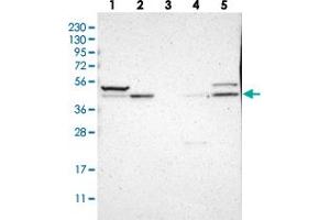 Western blot analysis of Lane 1: RT-4, Lane 2: U-251 MG, Lane 3: Human Plasma, Lane 4: Liver, Lane 5: Tonsil with SOX7 polyclonal antibody . (SOX7 anticorps)
