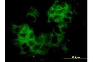 Immunofluorescence of monoclonal antibody to KRTHA3B on MCF-7 cell.