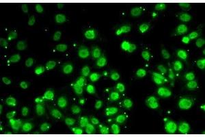 Immunofluorescence analysis of MCF7 cells using QKI Polyclonal Antibody (QKI anticorps)