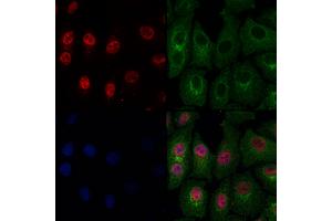 ABIN6263919 and ABIN6274026 staining Hela cells by IF/ICC. (OTX1 anticorps  (Internal Region))