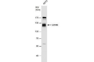 WB Image CD146 antibody detects CD146 protein by western blot analysis.