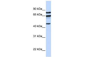 PPP4R2 antibody used at 1 ug/ml to detect target protein. (PPP4R2 anticorps  (C-Term))