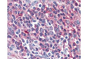 Anti-VIPR2 antibody IHC of human spleen. (VIPR2 anticorps  (Internal Region))