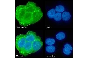 (ABIN184679) Immunofluorescence analysis of paraformaldehyde fixed A431 cells, permeabilized with 0. (NUMB anticorps  (C-Term))