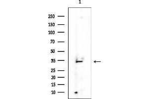 anti-Four and A Half LIM Domains 5 (FHL5) antibody