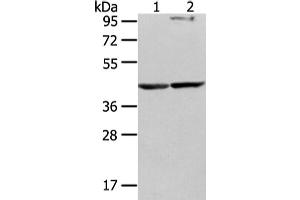 Western Blotting (WB) image for anti-WW Domain Containing Oxidoreductase (WWOX) antibody (ABIN5962023) (WWOX anticorps)
