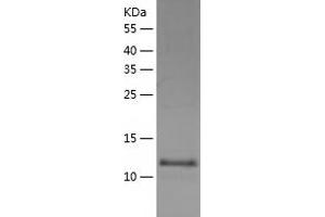 Western Blotting (WB) image for WW and C2 Domain Containing 1 (WWC1) (AA 655-783) protein (His tag) (ABIN7125743) (WWC1 Protein (AA 655-783) (His tag))