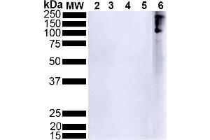 Western Blot analysis of Human Alpha Synuclein showing detection of Alpha Synuclein pSer129 protein using Rabbit Anti-Alpha Synuclein pSer129 Monoclonal Antibody, Clone J18 (ABIN6932882).