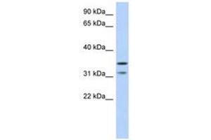 Image no. 1 for anti-Retinoic Acid Induced 12 (RAI12) (AA 143-192) antibody (ABIN6741255) (Retinoic Acid Induced 12 (RAI12) (AA 143-192) anticorps)