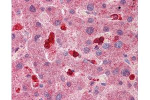 Anti-SLC8A3 antibody IHC of human liver.