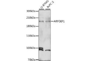 Western blot analysis of extracts of various cell lines, using  antibody (ABIN7265487) at 1:1000 dilution. (ARFGEF1 anticorps  (AA 220-420))