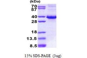 SDS-PAGE (SDS) image for F-Box Protein 6 (FBXO6) (AA 1-293) protein (His tag) (ABIN5853043)