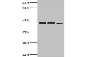 Western blot All lanes: Eukaryotic initiation factor 4A-I antibody at 3 μg/mL Lane 1: K562 whole cell lysate Lane 2: Hela whole cell lysate Lane 3: Rat brain tissue Secondary Goat polyclonal to rabbit IgG at 1/10000 dilution Predicted band size: 47, 40 kDa Observed band size: 47 kDa (EIF4A1 anticorps  (AA 167-406))