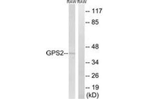 Western blot analysis of extracts from RAW264. (GPS2 anticorps  (AA 11-60))