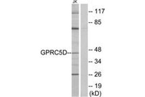 Western Blotting (WB) image for anti-G Protein-Coupled Receptor, Family C, Group 5, Member D (GPRC5D) (AA 271-320) antibody (ABIN2890864) (GPRC5D anticorps  (AA 271-320))