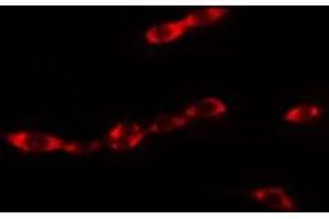 ABIN6275459 staining MCF7 cells by IF/ICC.