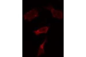 ABIN6274051 staining HepG2 by IF/ICC. (TLR9 anticorps  (Internal Region))