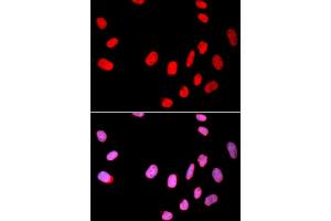 Immunofluorescence analysis of U2OS cells using CDC25C antibody (ABIN6130091, ABIN6138255, ABIN6138256 and ABIN6215163).