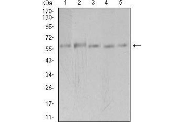 PAK3 Antikörper  (AA 1-100)