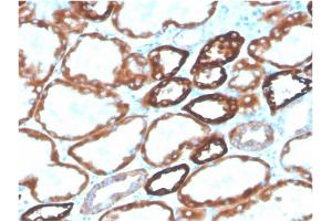 Formalin-fixed, paraffin-embedded human kidney stained with Biotin-conjugated CDH16Mouse Monoclonal Antibody (CDH16/2125). (Cadherin-16 anticorps  (AA 371-507) (Biotin))
