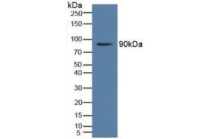 Western blot analysis of Human Serum. (Insulin Receptor anticorps  (AA 622-945))