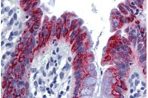 anti-Anterior Gradient Homolog 2 (Xenopus Laevis) (AGR2) (AA 101-150) antibody