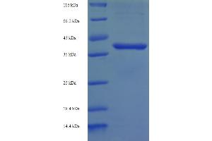 SDS-PAGE (SDS) image for B-Cell CLL/lymphoma 10 (BCL10) (AA 1-233), (full length) protein (His-SUMO Tag) (ABIN5709123)
