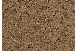 ABIN6265487 and ABIN6278641 at 1/100 staining Rat brain tissue by IHC-P. (T-Box 15/18 anticorps  (Internal Region))