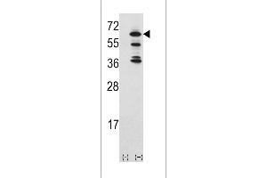 Western blot analysis of ACK1 (arrow) using rabbit polyclonal ACK1 Antibody (Center) (ABIN392084 and ABIN2841843). (TNK2 anticorps  (AA 383-411))