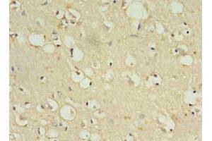 anti-Zinc Finger Protein 699 (ZNF699) (AA 19-195) antibody