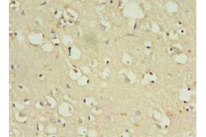 Immunohistochemistry of paraffin-embedded human brain tissue using ABIN7176501 at dilution of 1:100 (ZNF699 anticorps  (AA 19-195))