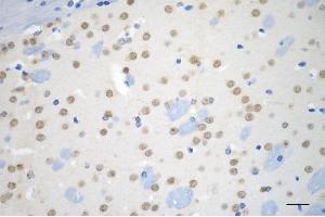 Immunohistochemistry was performed on paraffin-embedded mouse brain using ubiquitination factor E4 B antibody (ABIN7800713), 1:200).