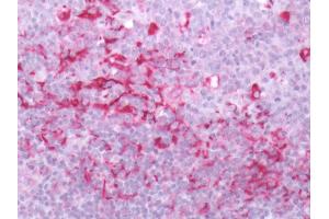 Human Tonsil: Formalin-Fixed, Paraffin-Embedded (FFPE)