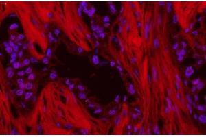 anti-Sequestosome 1 (SQSTM1) (AA 69-96), (N-Term) antibody