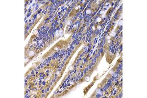 Immunohistochemistry of paraffin-embedded mouse ileum using HDGFRP2 antibody (ABIN5975300) at dilution of 1/100 (40x lens).