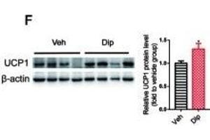 Diphyllin enhances brown/beige thermogenesis and reduces adipocyte size in DIO mice.