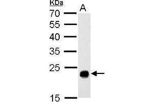 WB Image GSTT1 antibody detects GSTT1 protein by Western blot analysis.