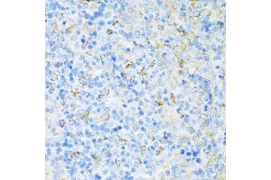 Immunohistochemistry of paraffin-embedded rat spleen using V antibody (ABIN6130774, ABIN6150046, ABIN6150047 and ABIN6224821) at dilution of 1:100 (40x lens).
