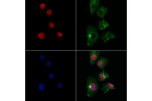 ABIN7093949 and ABIN7097993 staining Hela cells by IF/ICC.