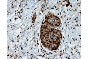 Immunohistochemical staining of paraffin-embedded liver tissue using anti-LTA4H mouse monoclonal antibody. (LTA4H anticorps)