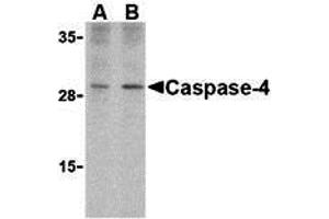 Western Blotting (WB) image for anti-Caspase 4, Apoptosis-Related Cysteine Peptidase (CASP4) (Middle Region) antibody (ABIN1030900)