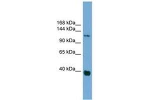 Image no. 1 for anti-Catenin (Cadherin-Associated Protein), delta 1 (CTNND1) (AA 827-876) antibody (ABIN6744923) (CTNND1 anticorps  (AA 827-876))